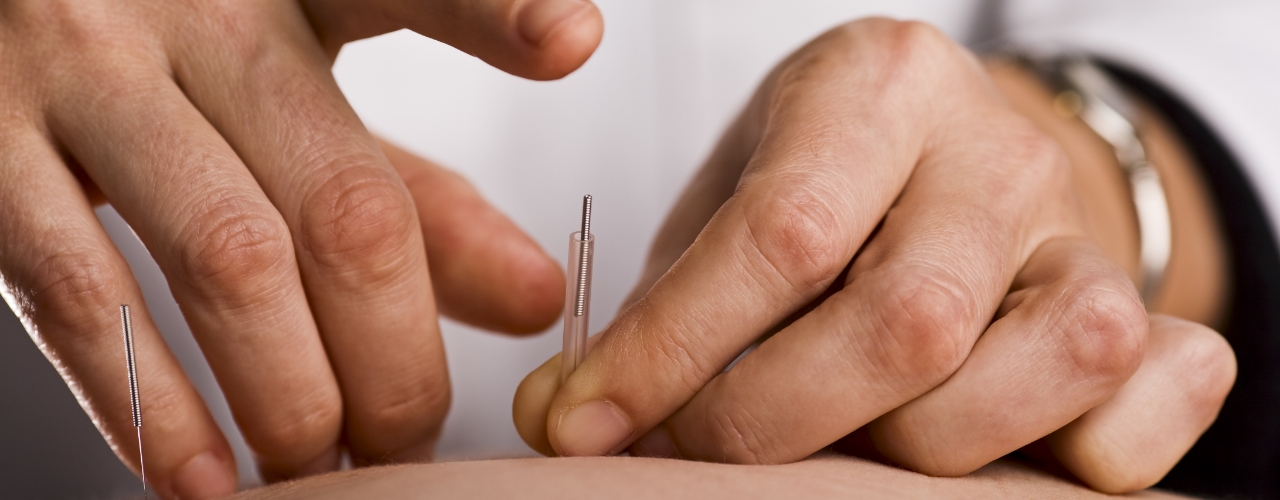 physical-therapy-clinic-dry-needling-professional-therapy-partners-new-mexico-nm-texas-tx